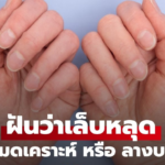 ฝันว่าเล็บหลุดออกจากมือ กำลังหมดเคราะห์ หรือ ลางบอกเหตุ พร้อมเลขเด็ด